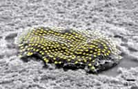 Réseau de la nanotechnologie d'or sur une cellule de fibroblaste. © Kam Sang Kwok &amp; Soo Jin Choi, Gracias Lab/Johns Hopkins University